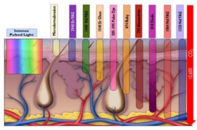 Diferenças entre os outros tipos de laser - Acorde Bem Clinica Médica